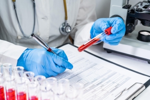 Nurse handling blood test vials